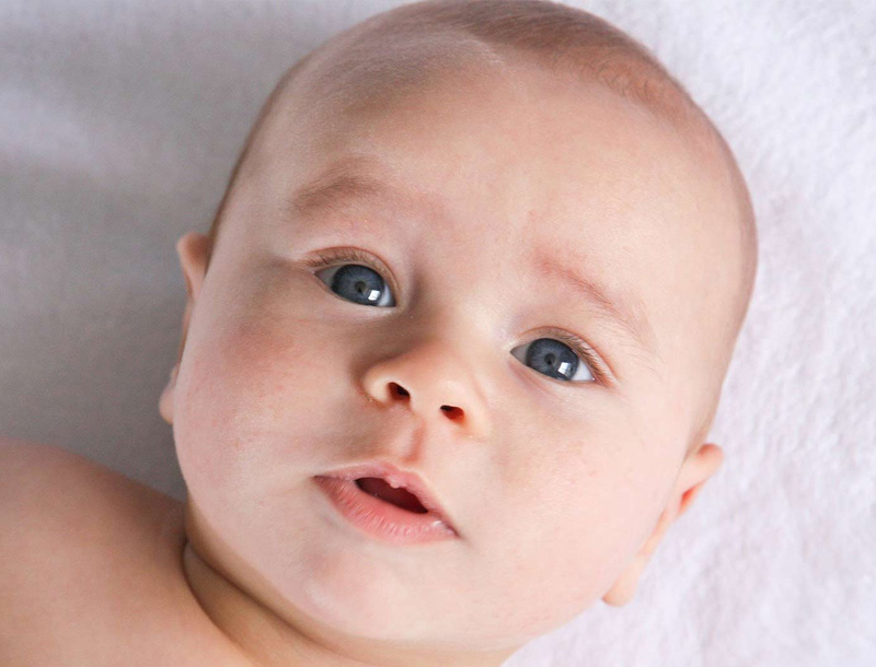 cleft lip cleft palate procedure