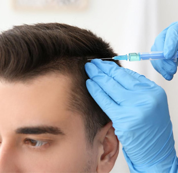 Follicular unit extraction (FUE)