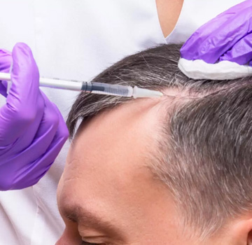 Platelet-Rich Plasma (PRP)