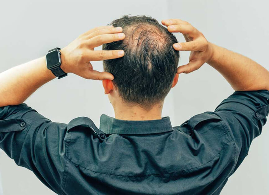 Hair Procedure